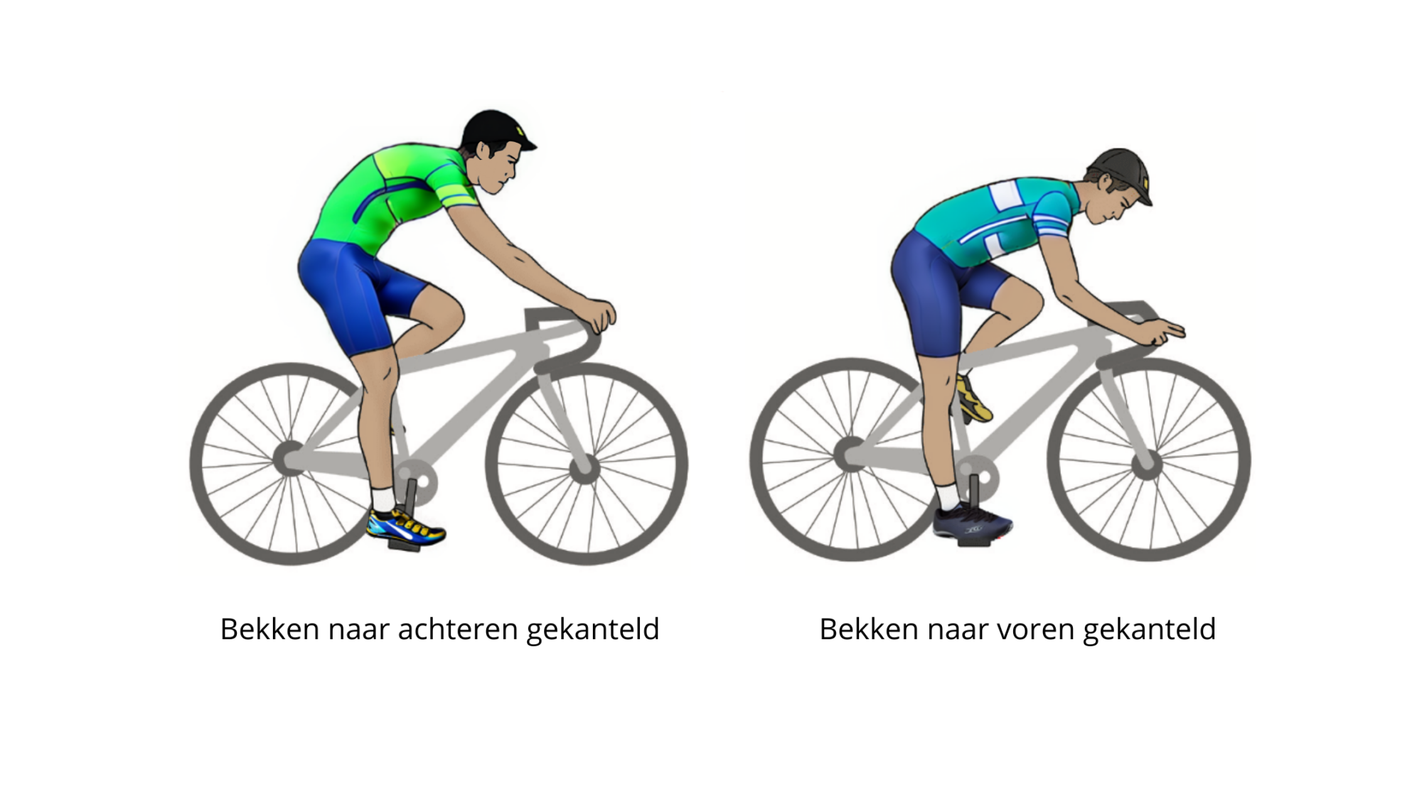 fietsafstelling-bekken-naar-achteren-voren